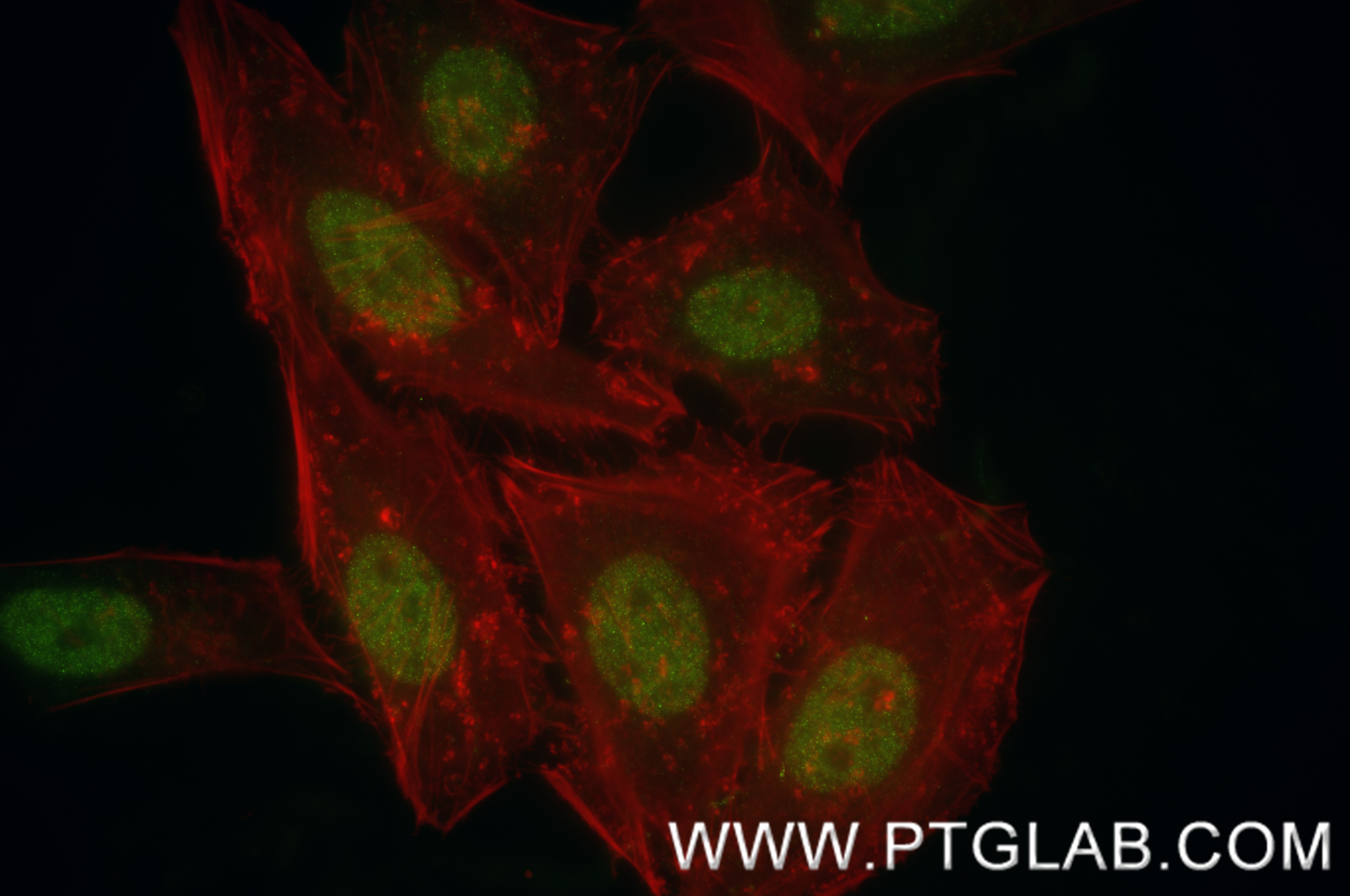 Immunofluorescence (IF) / fluorescent staining of HeLa cells using HNRNPU Recombinant antibody (84964-4-RR)