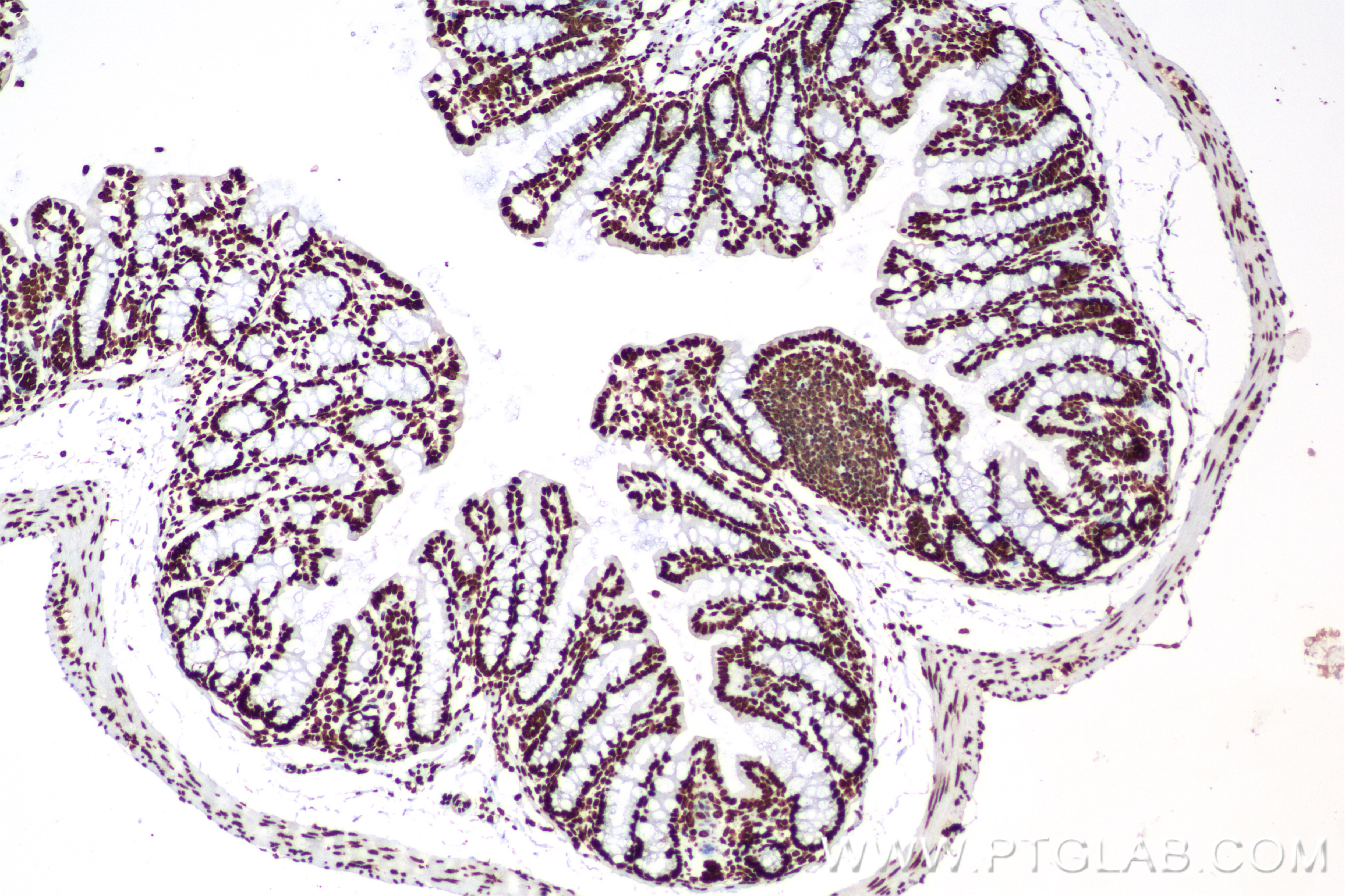 Immunohistochemistry (IHC) staining of mouse colon tissue using HNRNPU Recombinant antibody (84964-4-RR)