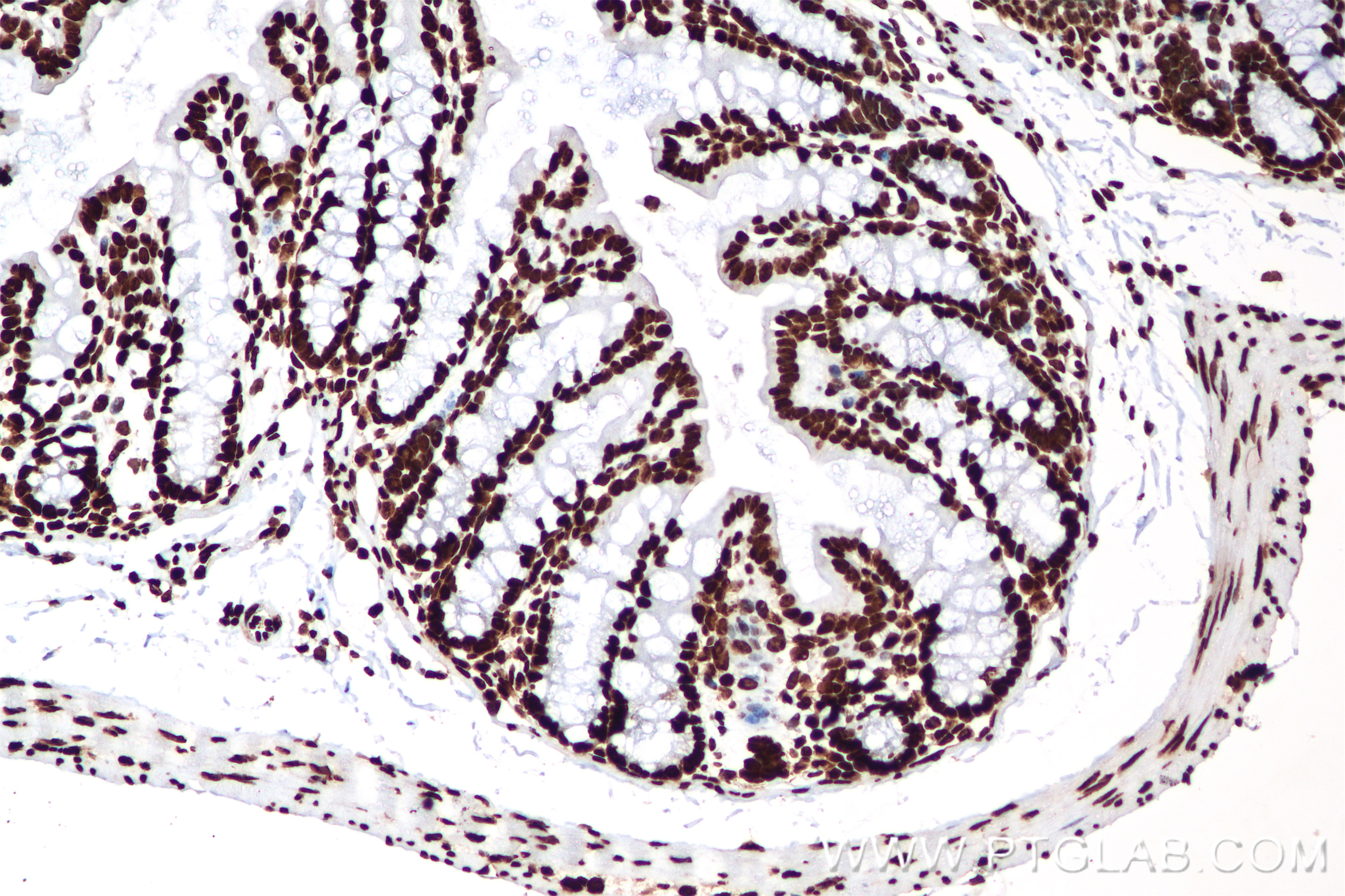 Immunohistochemistry (IHC) staining of mouse colon tissue using HNRNPU Recombinant antibody (84964-4-RR)