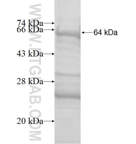 HNRNPU fusion protein Ag9144 SDS-PAGE HNRNPU fusion protein Ag9144 SDS-PAGE