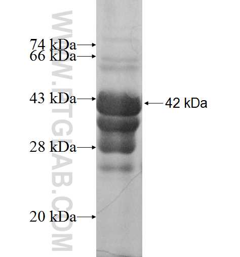 HNRNPU fusion protein Ag9151 SDS-PAGE