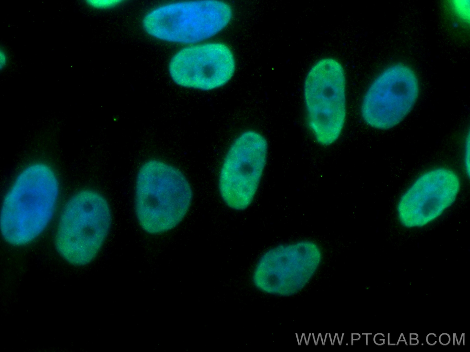 Immunofluorescence (IF) / fluorescent staining of HepG2 cells using HNRNPUL1 Polyclonal antibody (10578-1-AP)