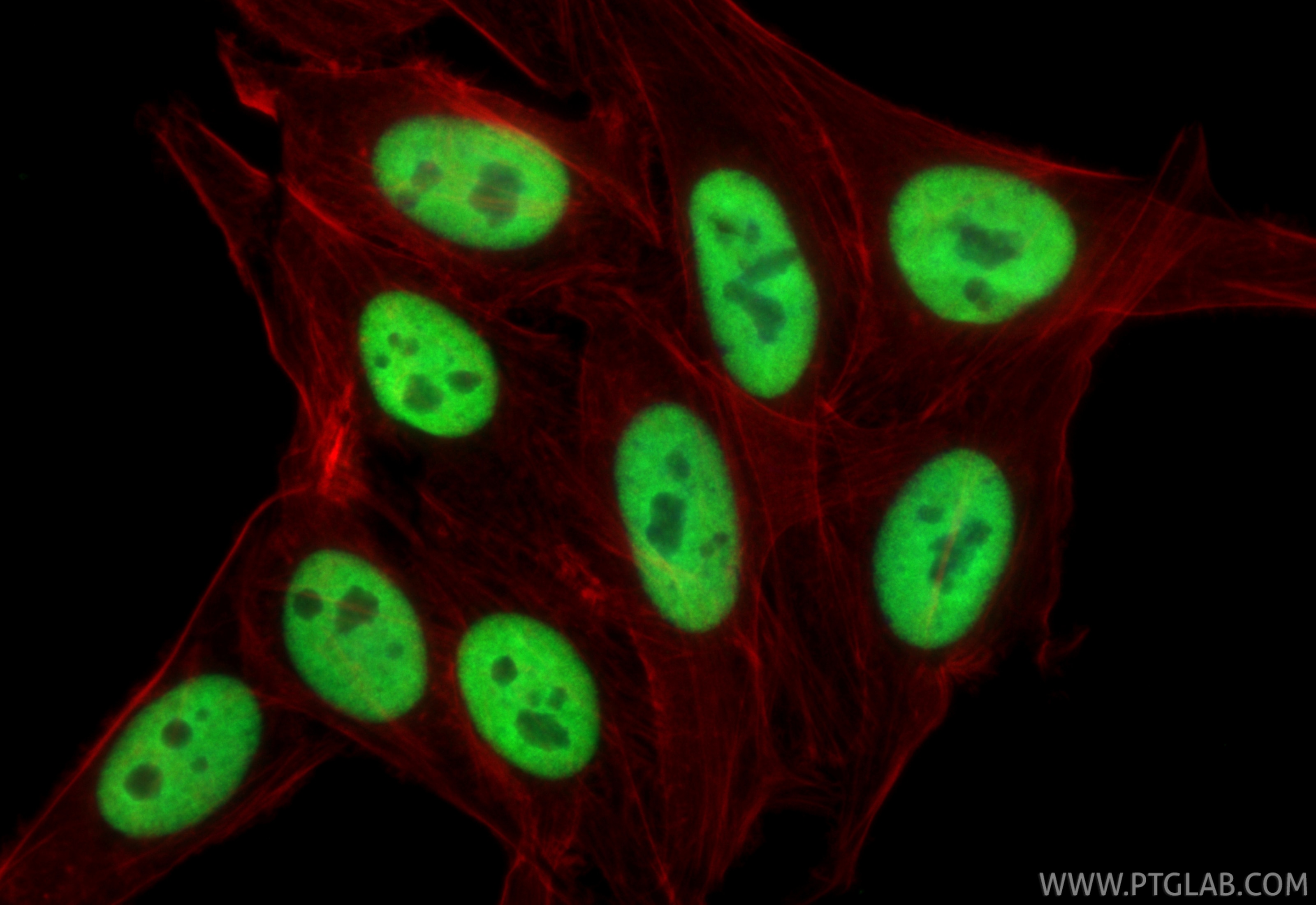 IF Staining of HepG2 using 10578-1-AP Immunofluorescence (IF) / fluorescent staining of HepG2 cells using HNRNPUL1 Polyclonal antibody (10578-1-AP)