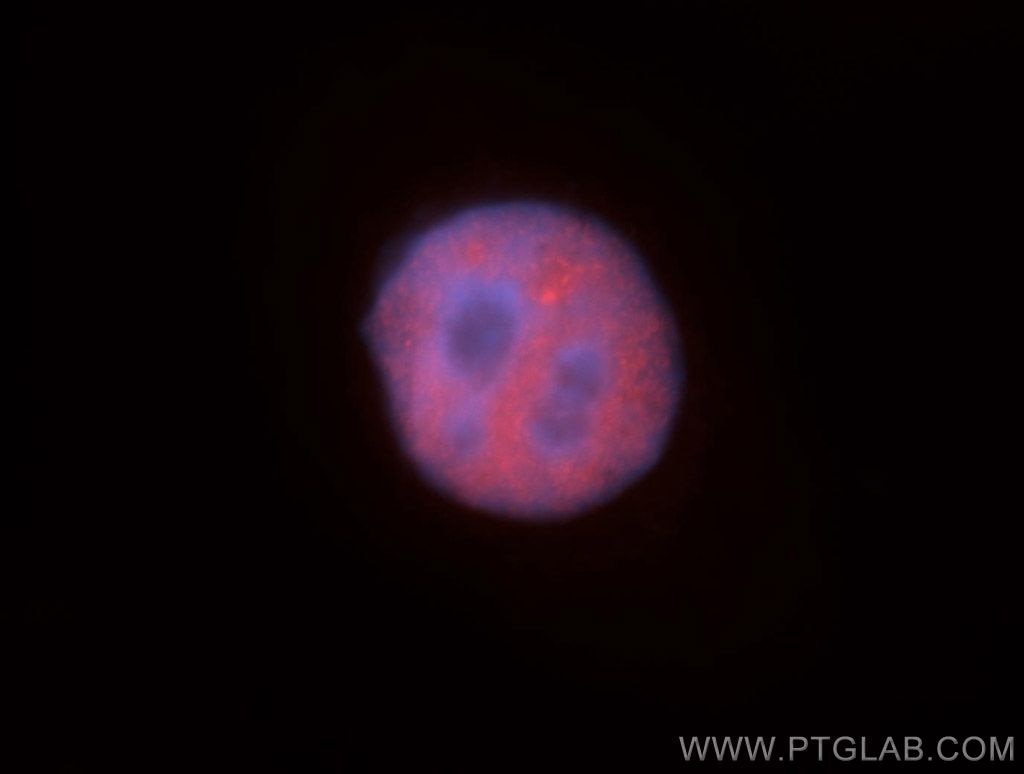 Immunofluorescence (IF) / fluorescent staining of HepG2 cells using HNRNPUL1 Polyclonal antibody (10578-1-AP)