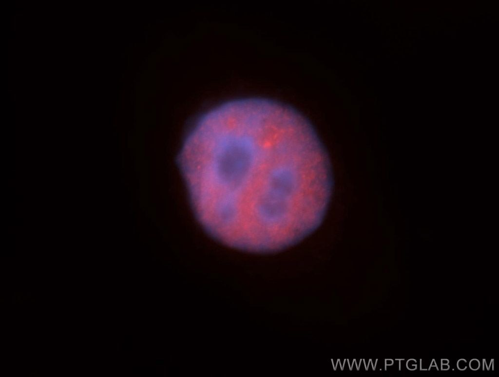 IF Staining of HepG2 using 10578-1-AP