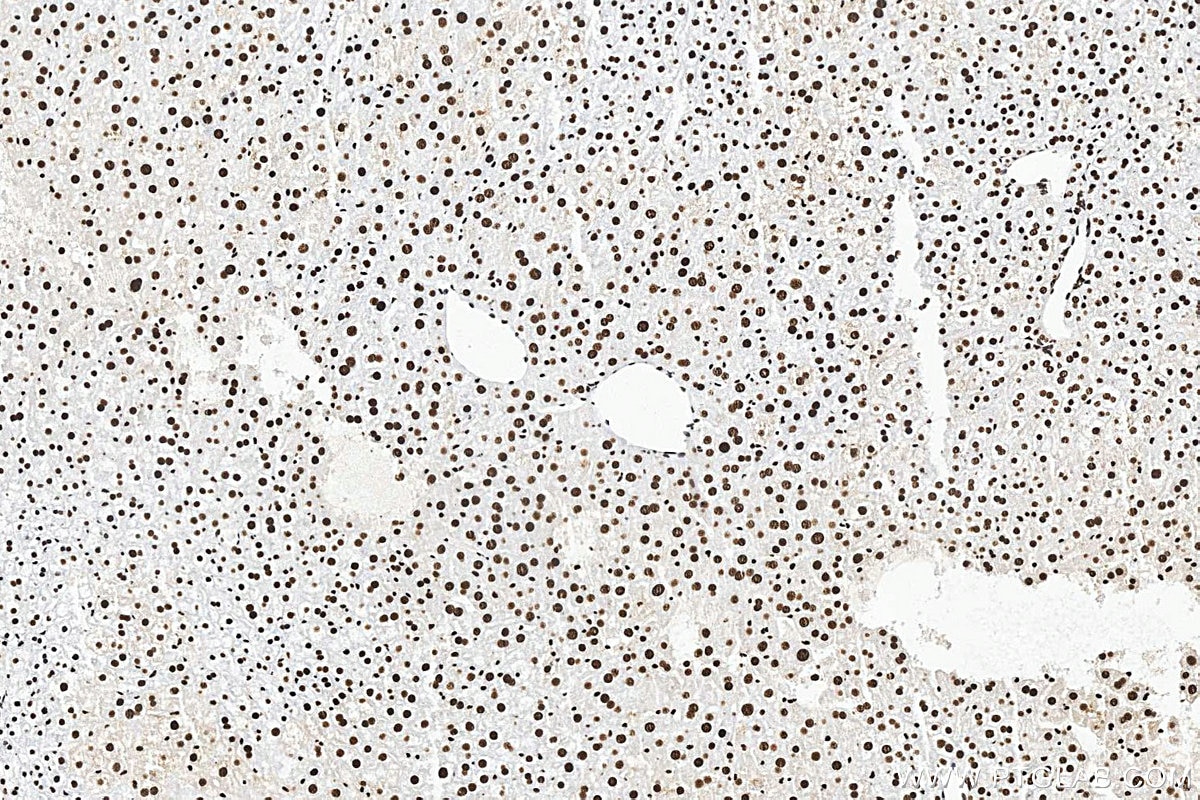 Immunohistochemistry (IHC) staining of mouse liver tissue using HNRNPUL1 Polyclonal antibody (10578-1-AP)
