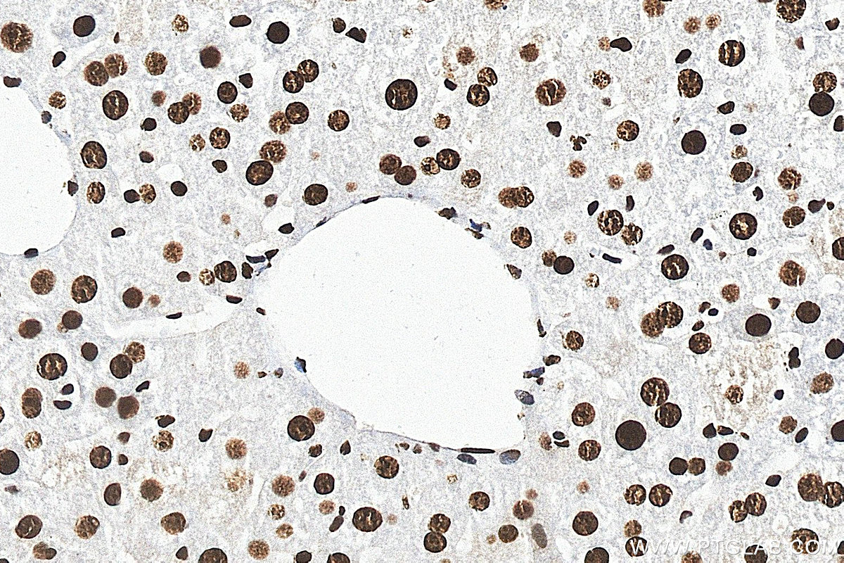 Immunohistochemistry (IHC) staining of mouse liver tissue using HNRNPUL1 Polyclonal antibody (10578-1-AP)