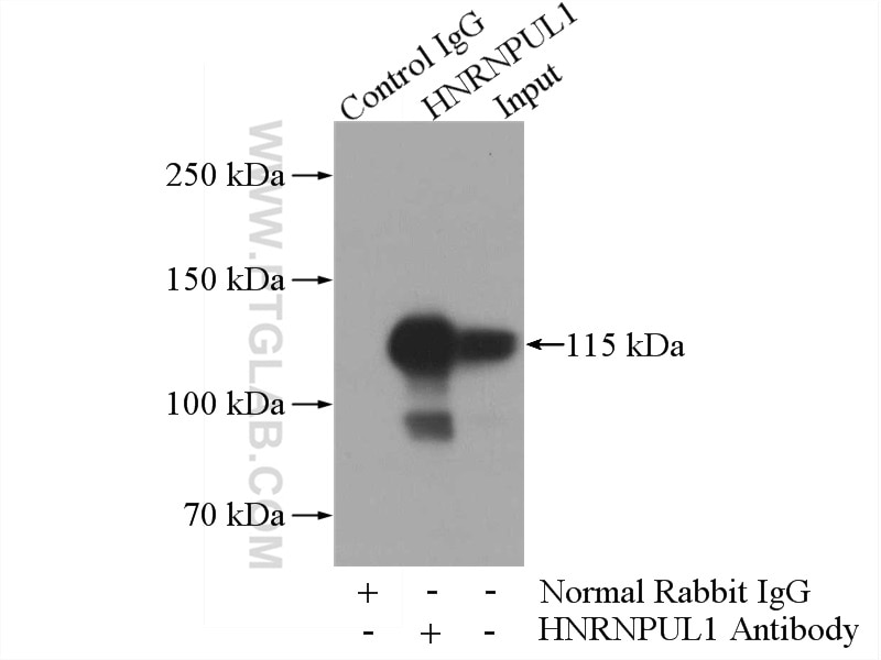 Immunoprecipitation (IP) experiment of HeLa cells using HNRNPUL1 Polyclonal antibody (10578-1-AP)