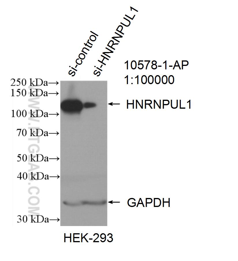 Western Blot (WB) analysis of HEK-293 cells using HNRNPUL1 Polyclonal antibody (10578-1-AP)