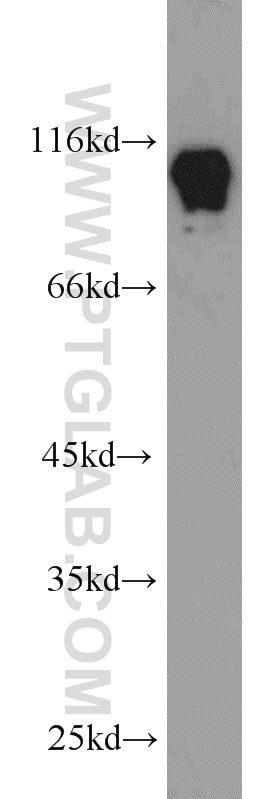 Western Blot (WB) analysis of MCF-7 cells using HNRNPUL1 Polyclonal antibody (10578-1-AP)