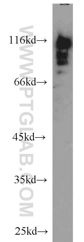 Western Blot (WB) analysis of HEK-293 cells using HNRNPUL1 Polyclonal antibody (10578-1-AP)