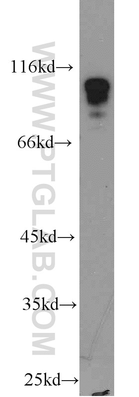 Western Blot (WB) analysis of mouse brain tissue using HNRNPUL1 Polyclonal antibody (10578-1-AP)