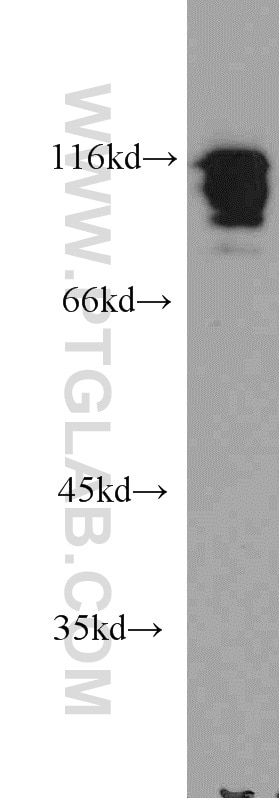 Western Blot (WB) analysis of A549 cells using HNRNPUL1 Polyclonal antibody (10578-1-AP)