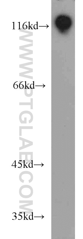 Western Blot (WB) analysis of HeLa cells using HNRNPUL1 Polyclonal antibody (10578-1-AP)