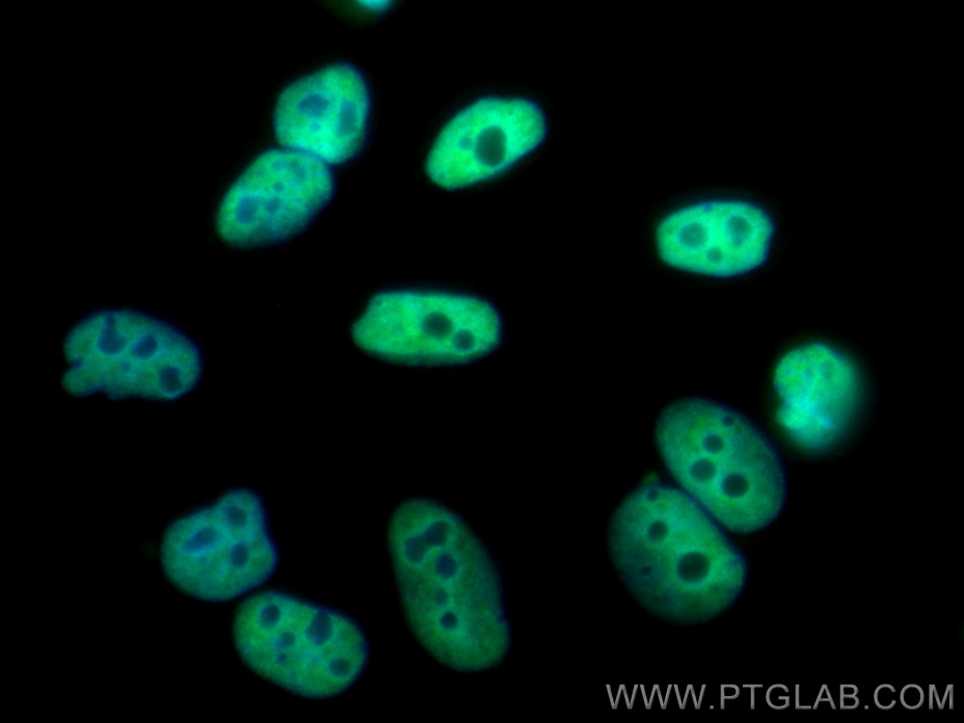Immunofluorescence (IF) / fluorescent staining of HepG2 cells using CoraLite® Plus 488-conjugated HNRNPUL1 Polyclonal  (CL488-10578)