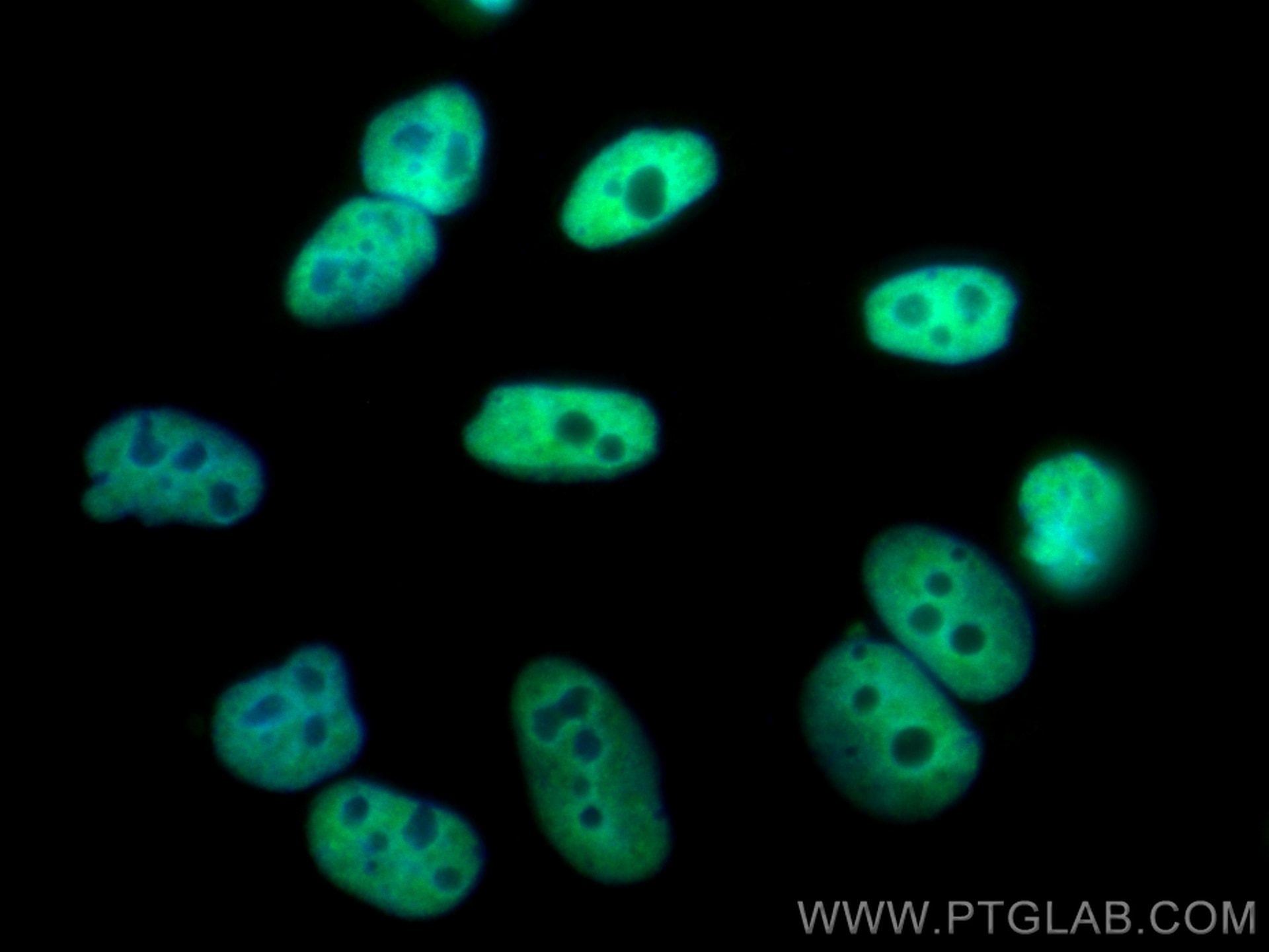 IF Staining of HepG2 using CL488-10578