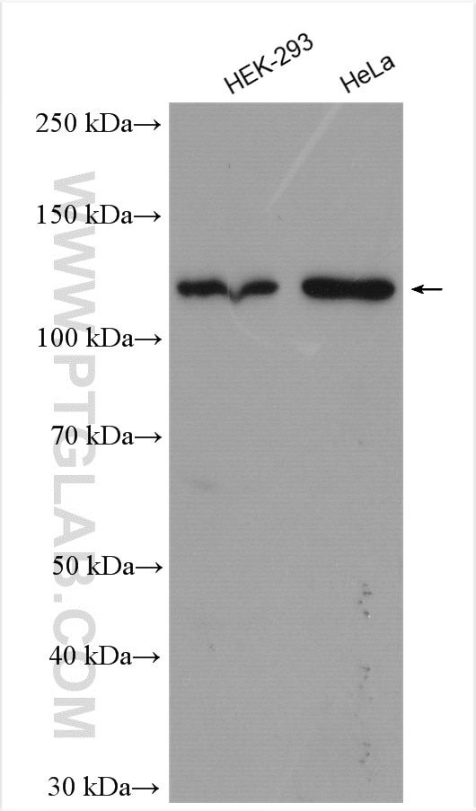 Western Blot (WB) analysis of various lysates using HNRNPUL2-Specific Polyclonal antibody (20143-1-AP)