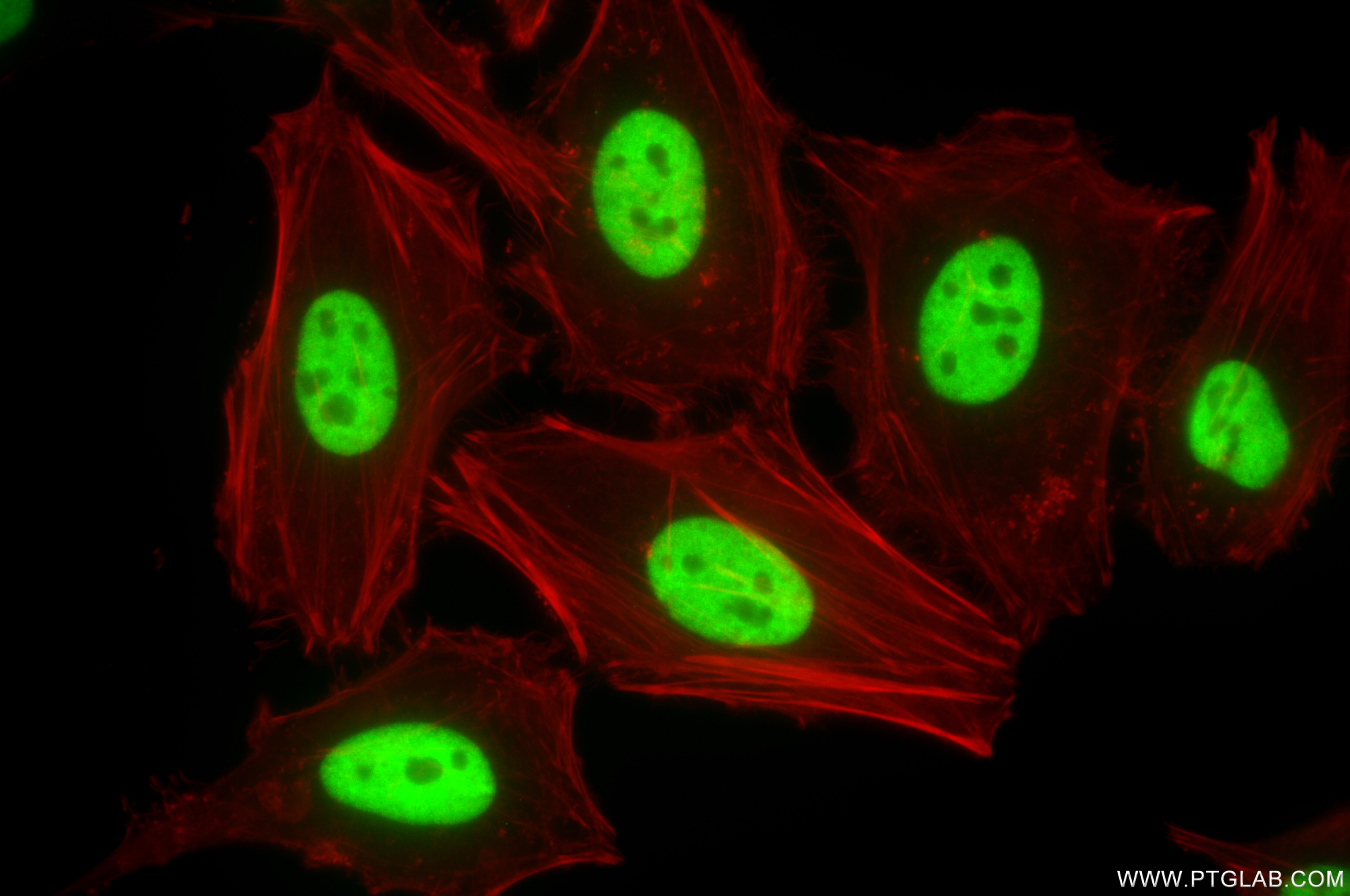Immunofluorescence (IF) / fluorescent staining of HeLa cells using HNRNPUL2-Specific Recombinant antibody (85739-1-RR)