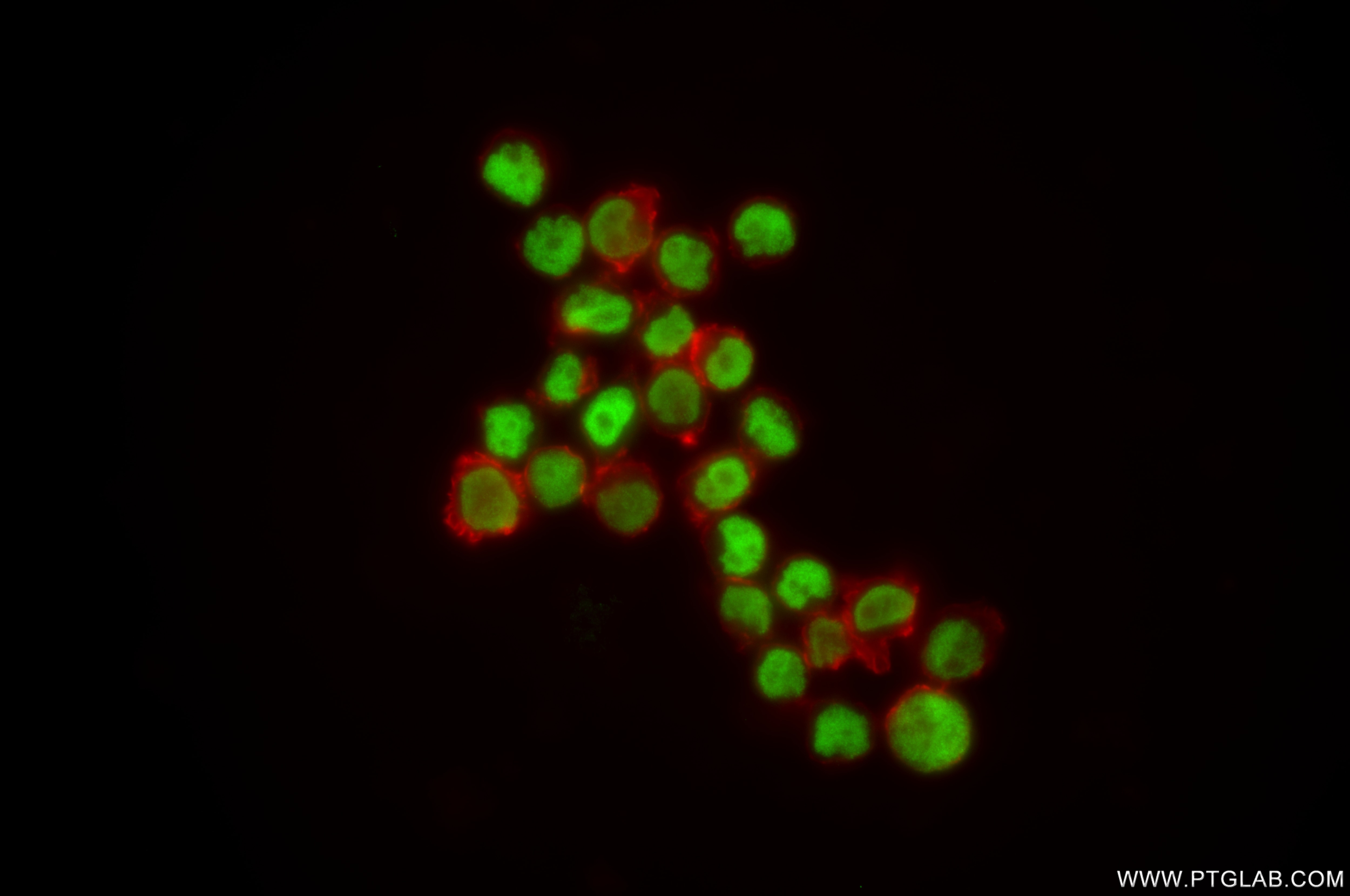 Immunofluorescence (IF) / fluorescent staining of Jurkat cells using HNRNPUL2-Specific Recombinant antibody (85739-1-RR)