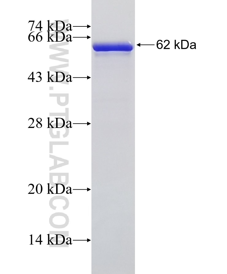 HNRPDL fusion protein Ag1046 SDS-PAGE