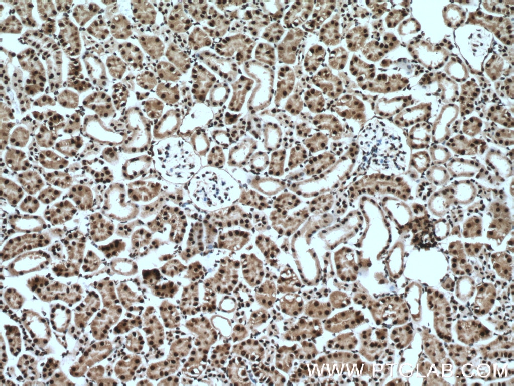 Immunohistochemistry (IHC) staining of mouse kidney tissue using HNRPLL Polyclonal antibody (26769-1-AP)