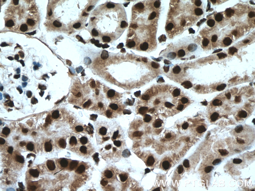 Immunohistochemistry (IHC) staining of mouse kidney tissue using HNRPLL Polyclonal antibody (26769-1-AP)