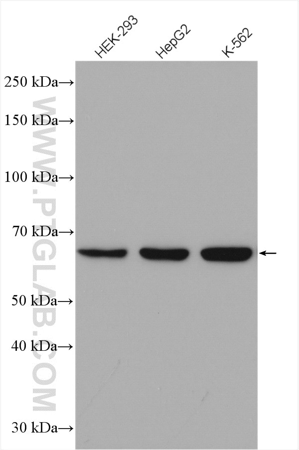 Western Blot (WB) analysis of various lysates using HNRPLL Polyclonal antibody (26769-1-AP)