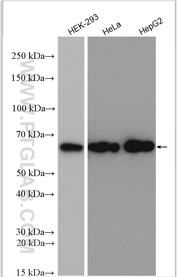 Western Blot (WB) analysis of various lysates using HNRPLL Polyclonal antibody (26769-1-AP)