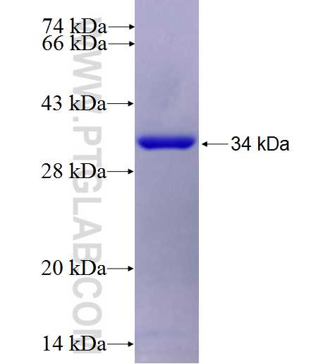 HNRPLL fusion protein Ag25287 SDS-PAGE