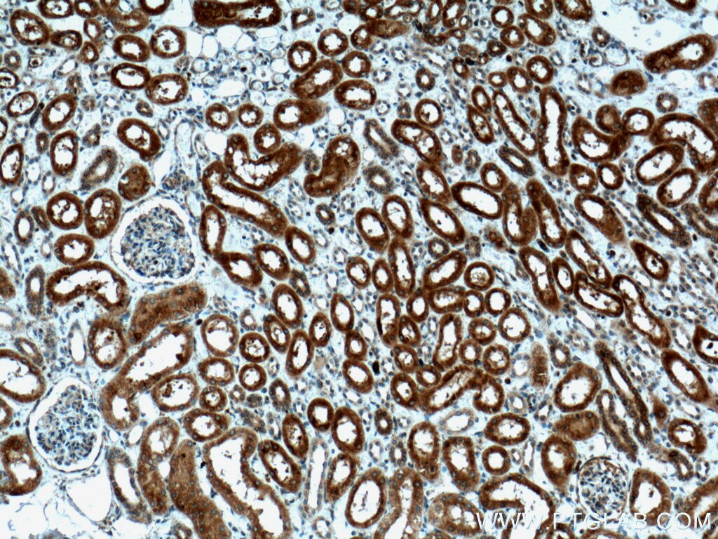 Immunohistochemistry (IHC) staining of human kidney tissue using HO-1/HMOX1 Polyclonal antibody (27282-1-AP)