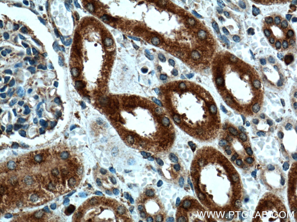 Immunohistochemistry (IHC) staining of human kidney tissue using HO-1/HMOX1 Polyclonal antibody (27282-1-AP)