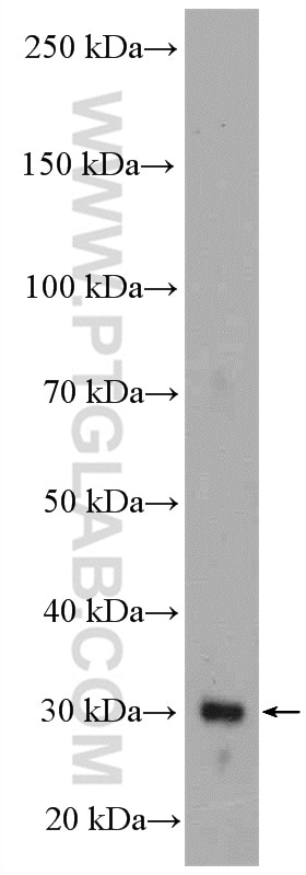 WB analysis of A549 using 27282-1-AP