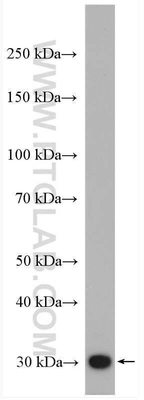 Western Blot (WB) analysis of HeLa cells using HO-1/HMOX1 Polyclonal antibody (27282-1-AP)