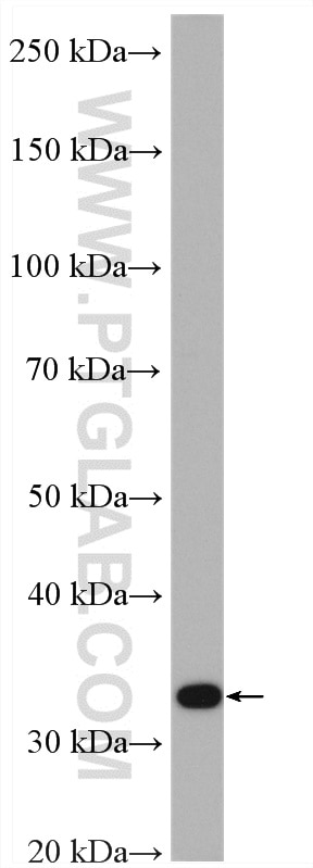 WB analysis of mouse spleen using 27282-1-AP