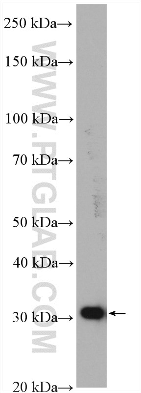Western Blot (WB) analysis of HeLa cells using HO-1/HMOX1 Polyclonal antibody (27282-1-AP)