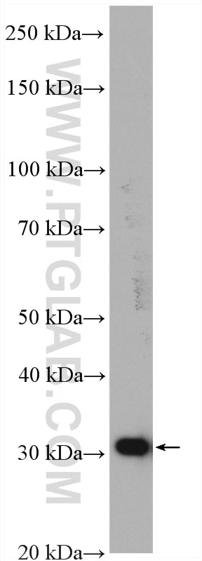 WB analysis of HeLa using 27282-1-AP