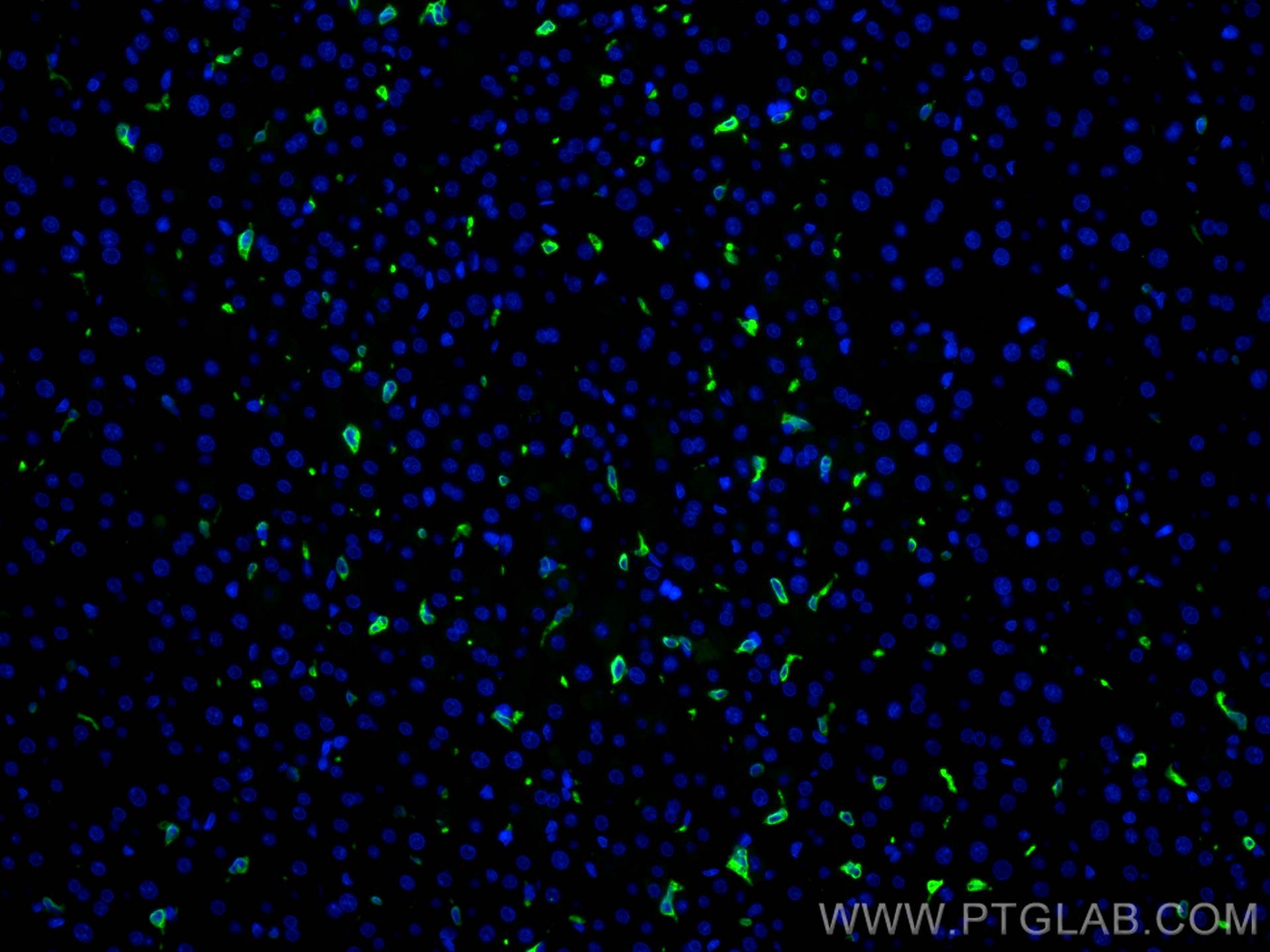 Immunofluorescence (IF) / fluorescent staining of rat liver tissue using HO-1/HMOX1 Monoclonal antibody (66743-1-Ig)