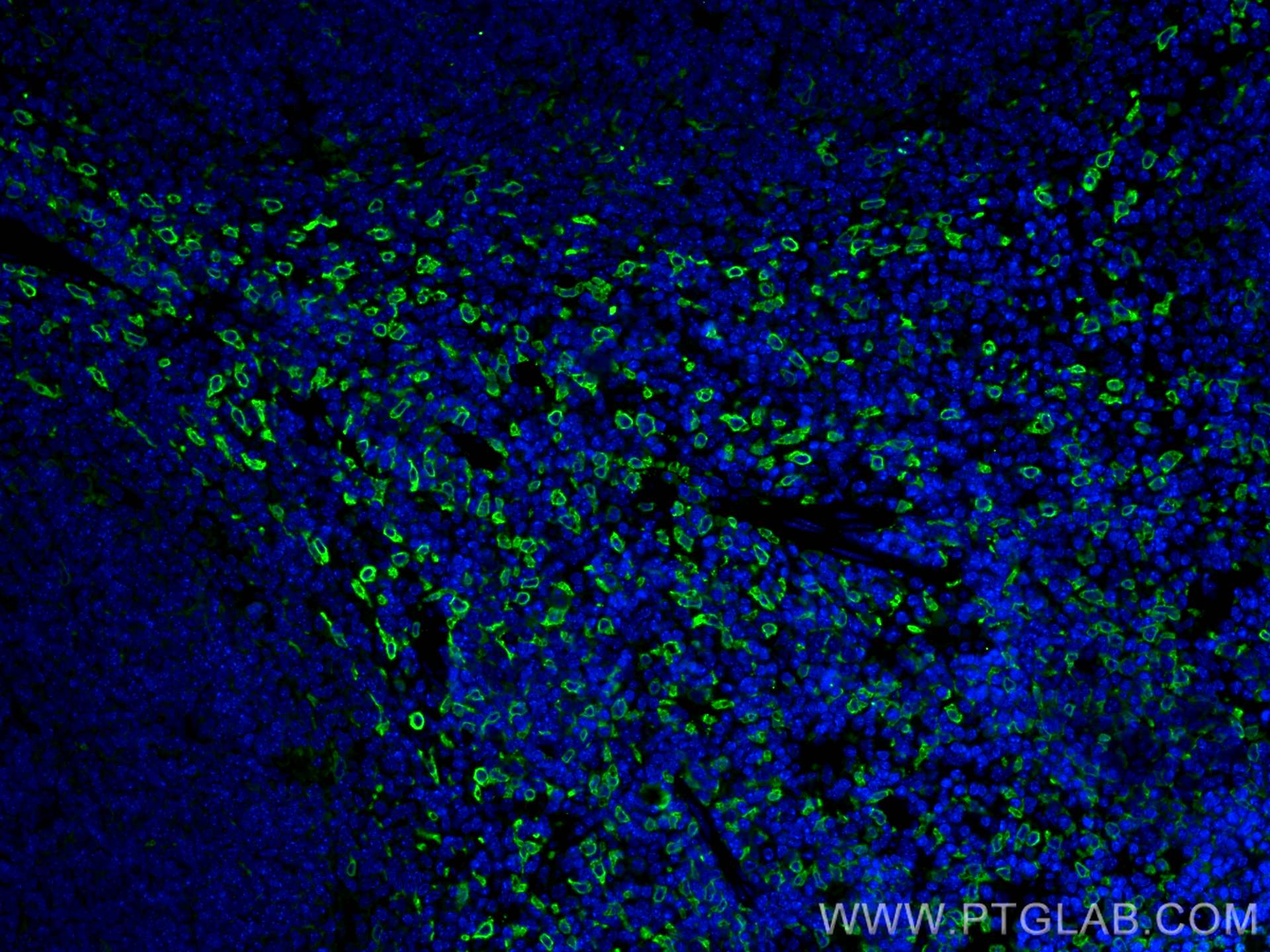 Immunofluorescence (IF) / fluorescent staining of mouse spleen tissue using HO-1/HMOX1 Monoclonal antibody (66743-1-Ig)