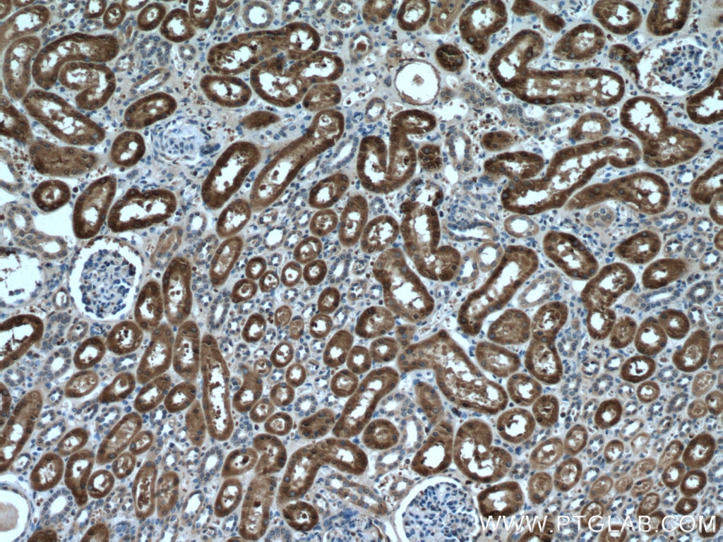 IHC staining of human kidney using 66743-1-Ig