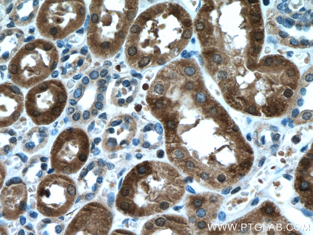 Immunohistochemistry (IHC) staining of human kidney tissue using HO-1/HMOX1 Monoclonal antibody (66743-1-Ig)