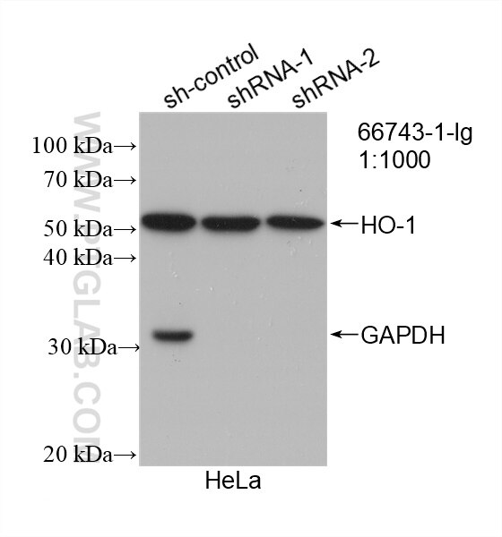 Western Blot (WB) analysis of HeLa cells using HO-1/HMOX1 Monoclonal antibody (66743-1-Ig)