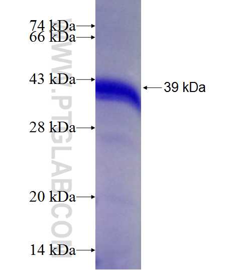 HO-1 fusion protein Ag21296 SDS-PAGE