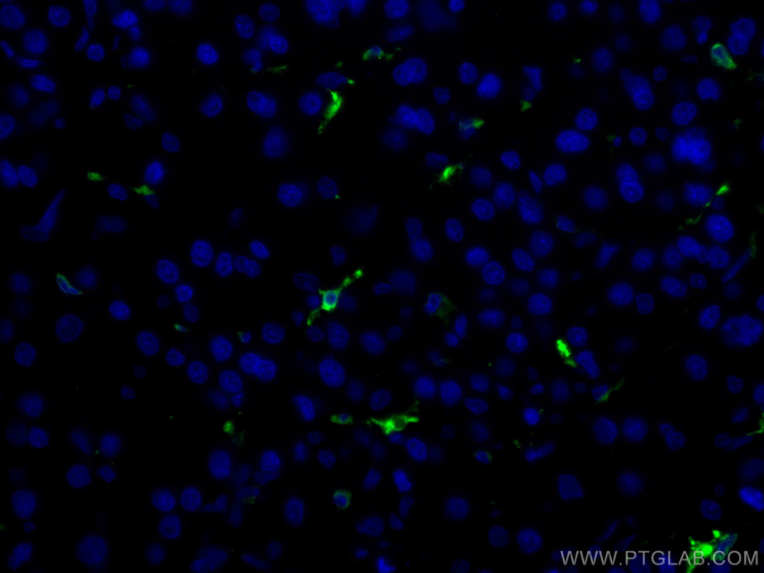 Immunofluorescence (IF) / fluorescent staining of human liver cancer tissue using CoraLite® Plus 488-conjugated HO-1/HMOX1 Polyclona (CL488-10701)