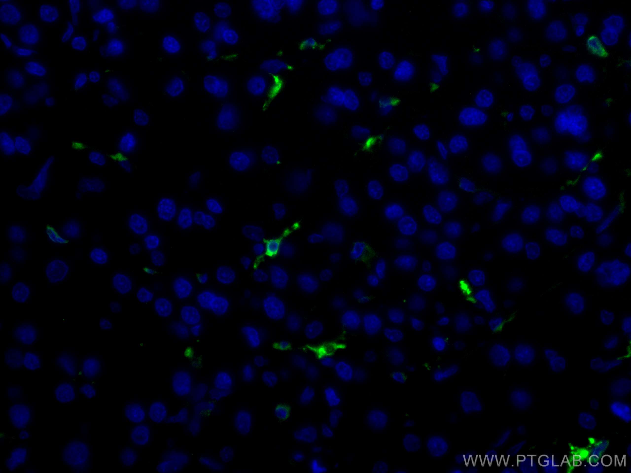 IF Staining of human liver cancer using CL488-10701