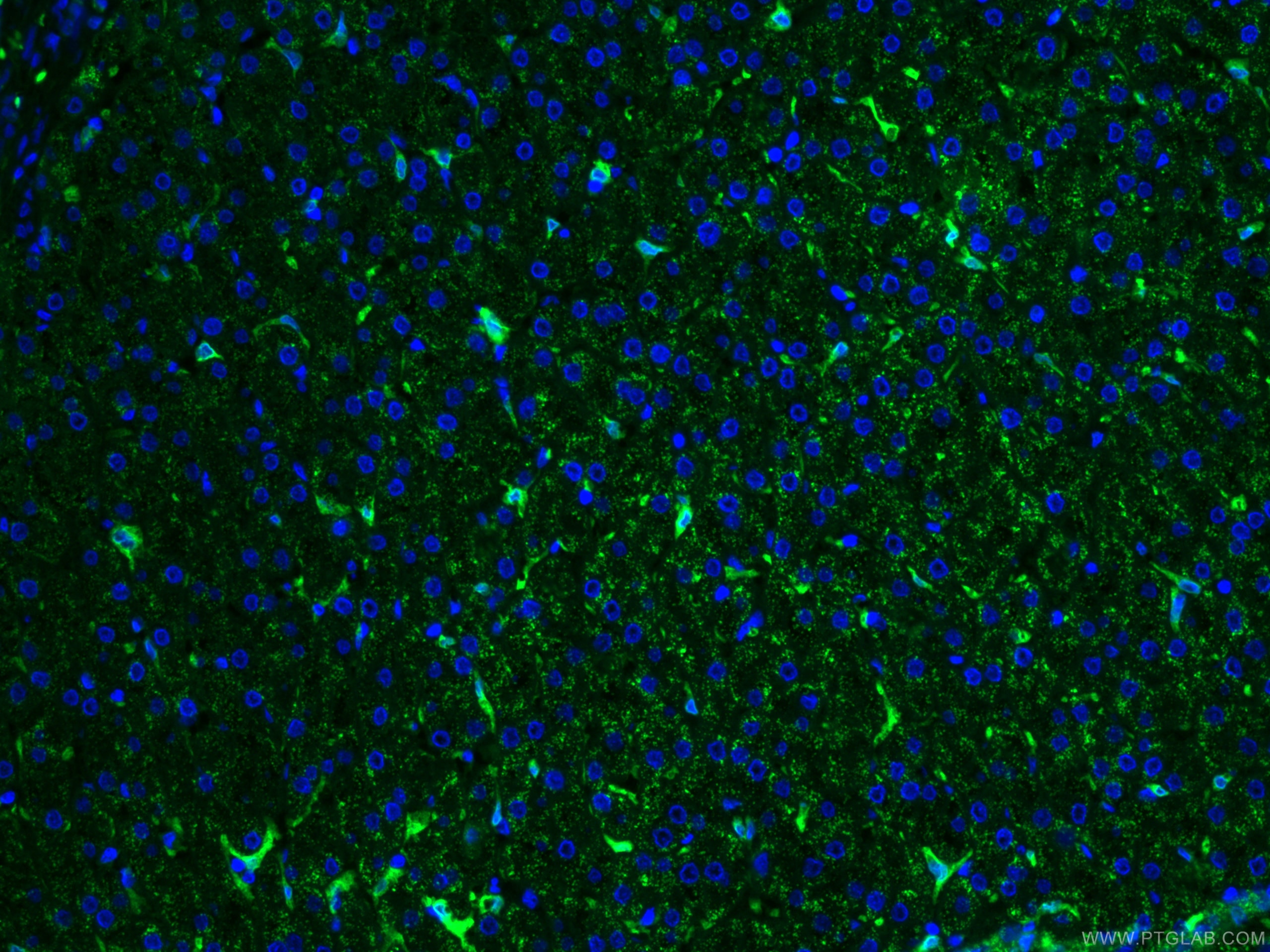 Immunofluorescence (IF) / fluorescent staining of human liver tissue using CoraLite®488-conjugated HO-1/HMOX1 Monoclonal anti (CL488-66743)
