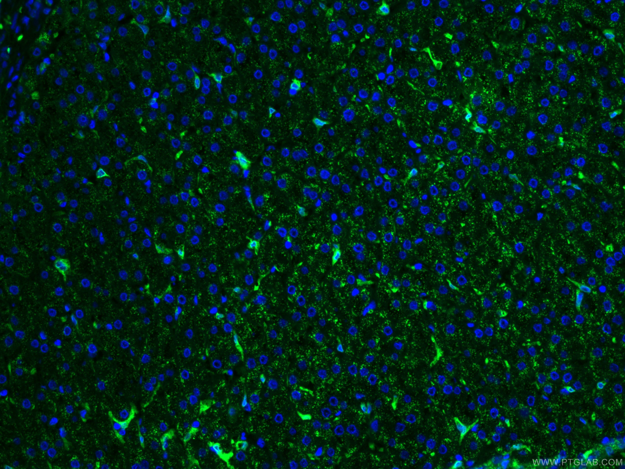 Immunofluorescence (IF) / fluorescent staining of human liver tissue using CoraLite® Plus 488-conjugated HO-1/HMOX1 Monoclona (CL488-66743)