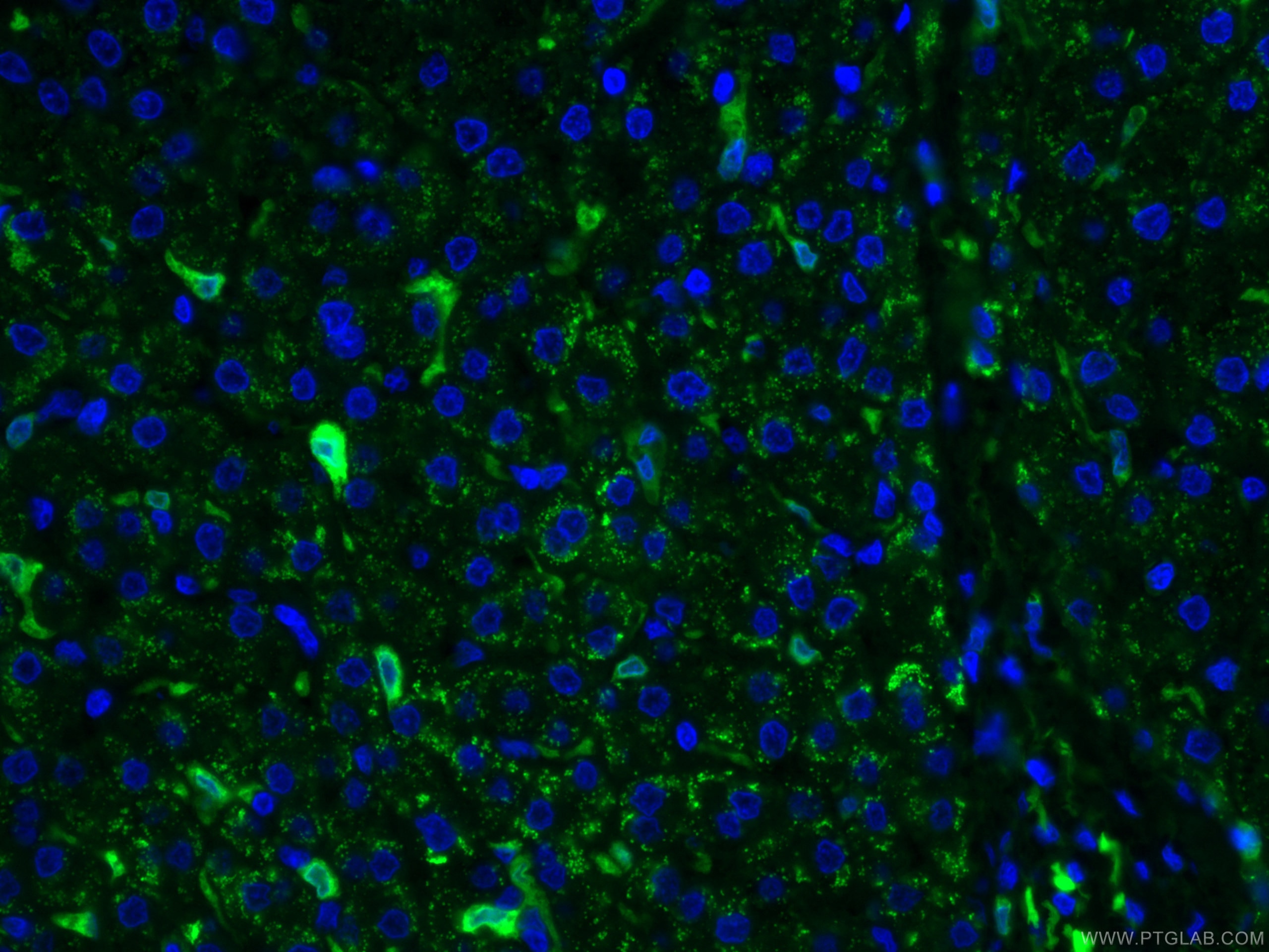 Immunofluorescence (IF) / fluorescent staining of human liver tissue using CoraLite® Plus 488-conjugated HO-1/HMOX1 Monoclona (CL488-66743)