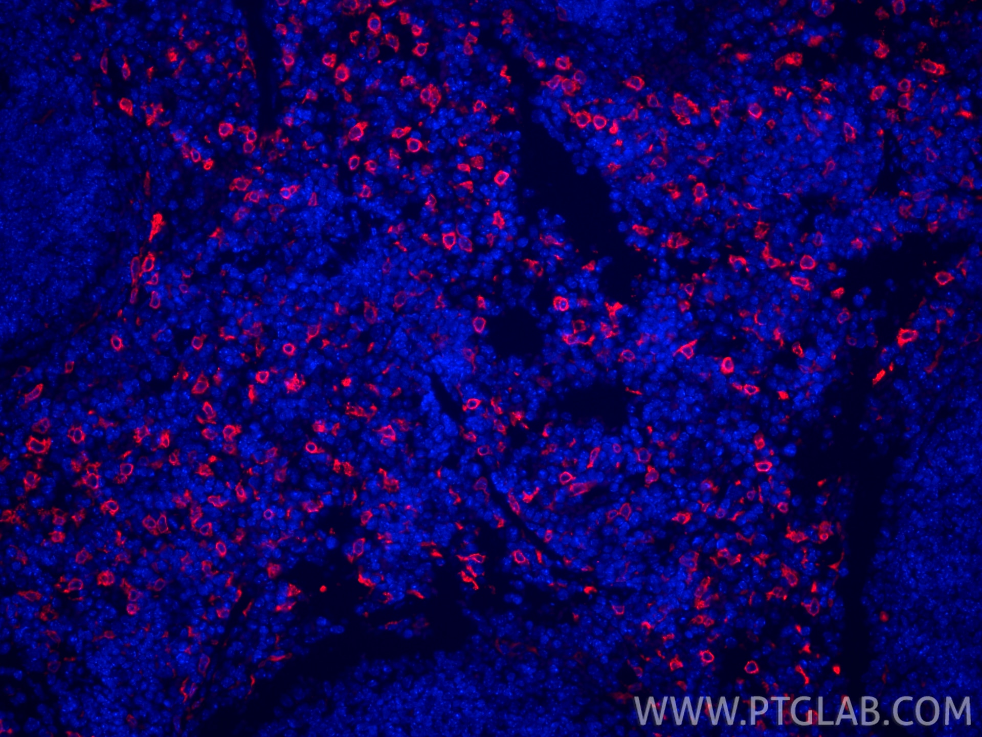 Immunofluorescence (IF) / fluorescent staining of mouse spleen tissue using CoraLite®594-conjugated HO-1/HMOX1 Polyclonal anti (CL594-10701)
