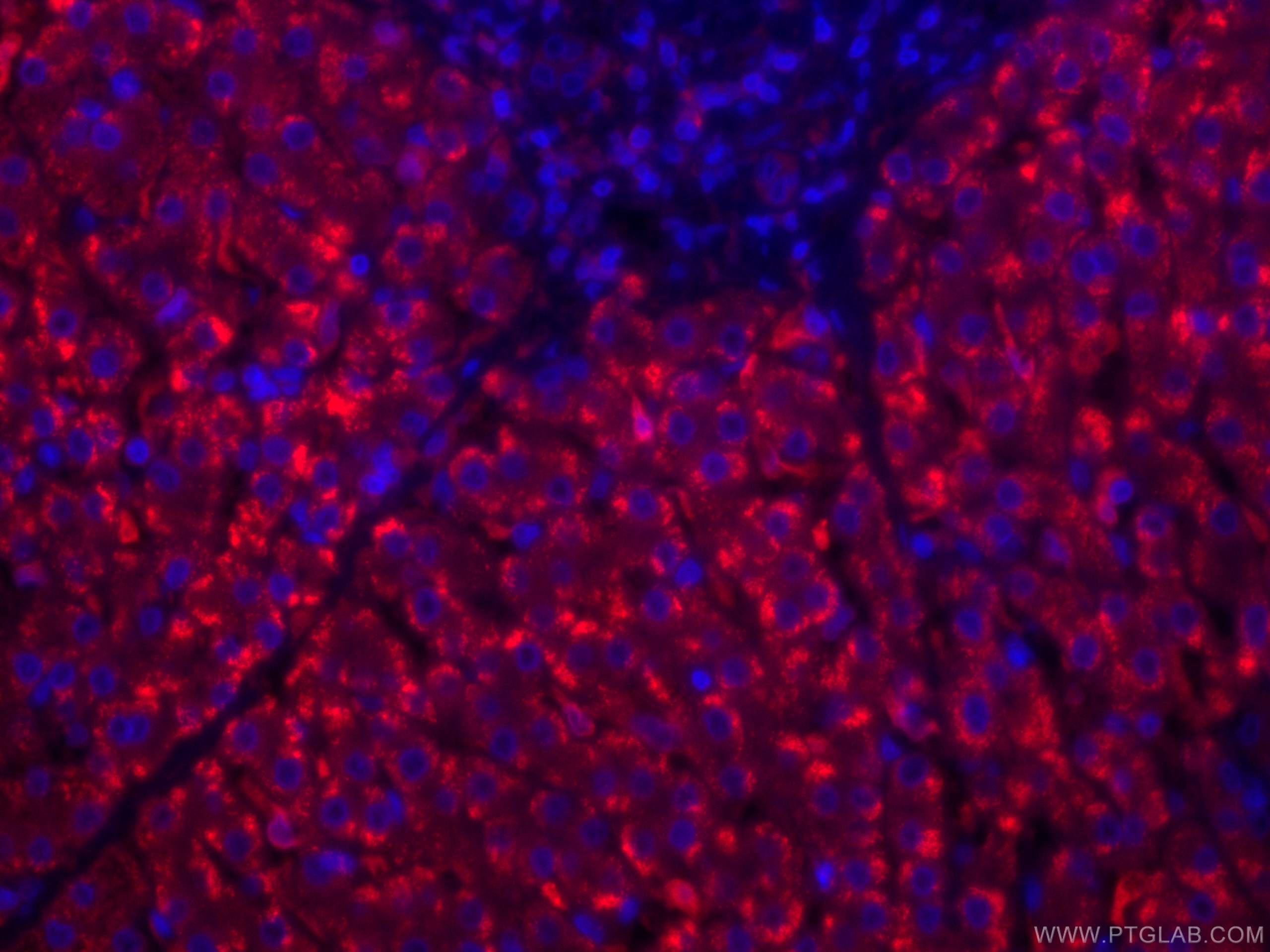 Immunofluorescence (IF) / fluorescent staining of human liver tissue using CoraLite®594-conjugated HO-1/HMOX1 Monoclonal anti (CL594-66743)