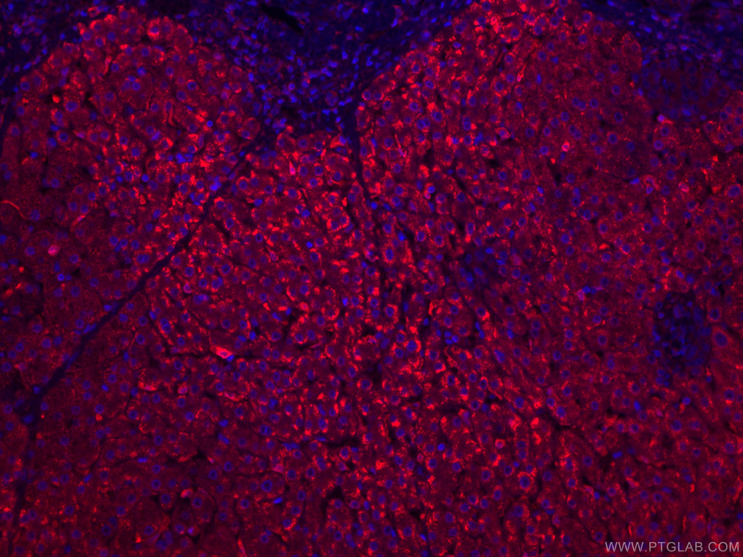 Immunofluorescence (IF) / fluorescent staining of human liver tissue using CoraLite®594-conjugated HO-1/HMOX1 Monoclonal anti (CL594-66743)